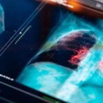 Sigara içmeyenlerde akciğer kanseri neden ortaya çıkıyor?